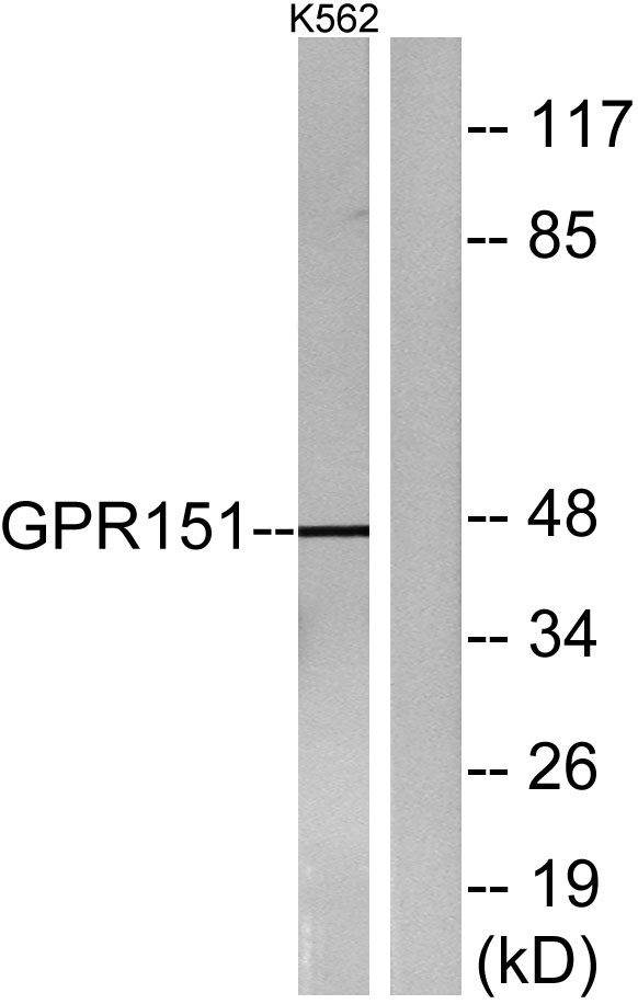a30814 gpr151 primary antibodies wb testing 2