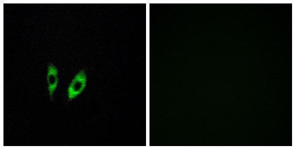 a30817 gpr156 primary antibodies if testing 1