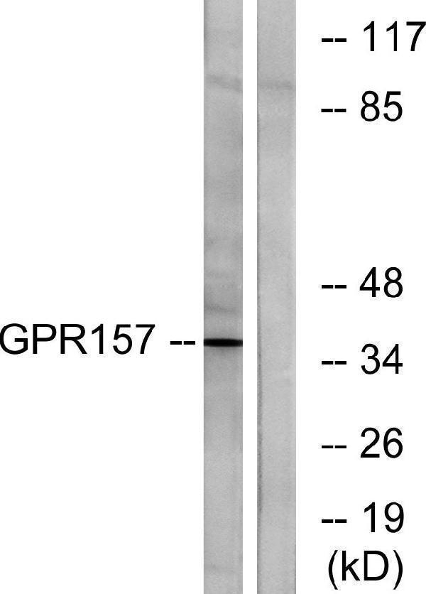 a30818 gpr157 primary antibodies wb testing 2