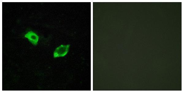 a30819 gpr158 primary antibodies if testing 1
