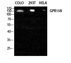 a30819 gpr158 primary antibodies wb testing 3