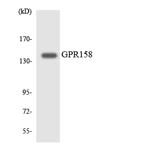 a30819 gpr158 primary antibodies wb testing 5