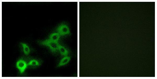 Immunofluorescence analysis of LOVO cells, using GPBAR Antibody