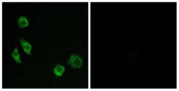 a30828 gprc5d primary antibodies if testing 1