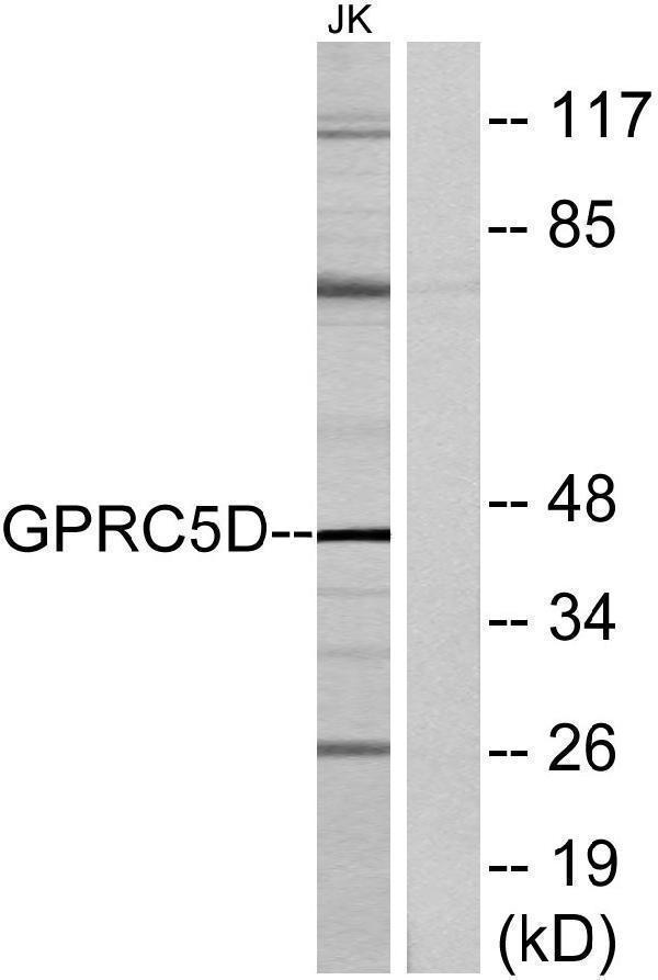 a30828 gprc5d primary antibodies wb testing 2