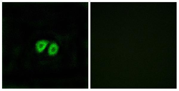 Immunofluorescence analysis of MCF7 cells, using GPR56 Antibody