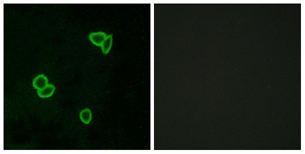 a30832 adgrl1 primary antibodies if testing 1