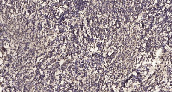 a30832 adgrl1 primary antibodies ihc testing 2