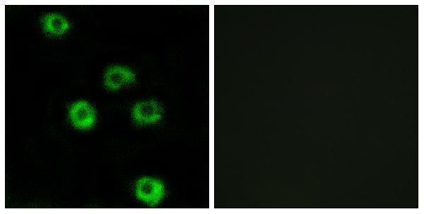a30833 adgrl2 primary antibodies if testing 1
