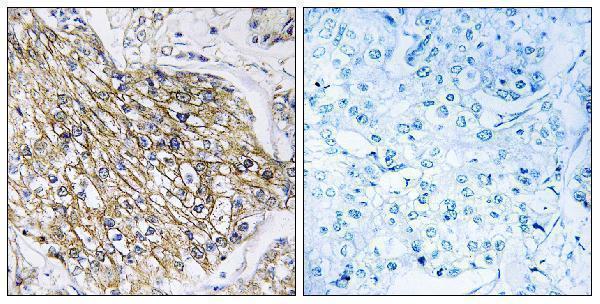 a30833 adgrl2 primary antibodies ihc testing 2