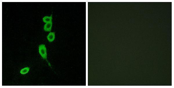a30842 mc1r primary antibodies if testing 1