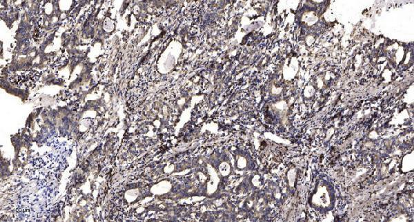 a30842 mc1r primary antibodies ihc testing 2
