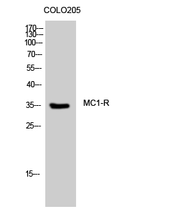 a30842 mc1r primary antibodies wb testing 3