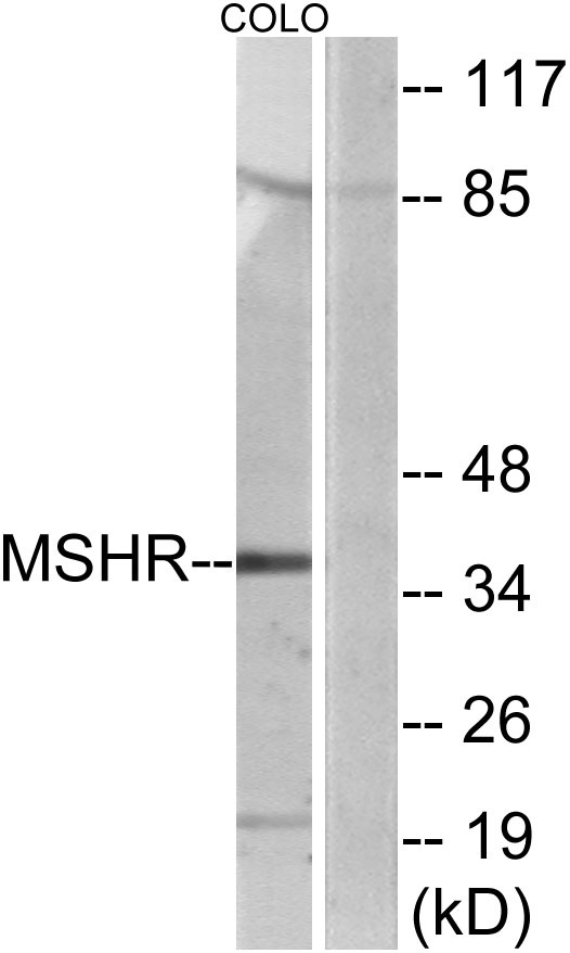 a30842 mc1r primary antibodies wb testing 4