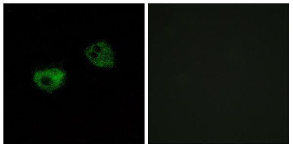 Immunofluorescence analysis of HepG2 cells, using MTR1A Antibody