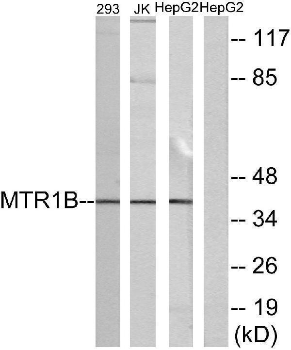 a30844 mtnr1b primary antibodies wb testing 4