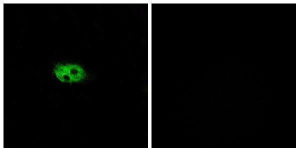 a30848 tacr3 primary antibodies if testing 1