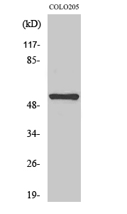 Western Blot analysis of COLO205 cells using NK-3R Polyclonal Antibody