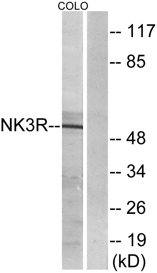 a30848 tacr3 primary antibodies wb testing 4