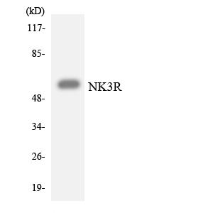 Western blot analysis of the lysates from HepG2 cells using NK3R antibody