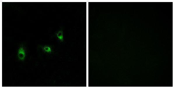 a30855 or10g2 primary antibodies if testing 1