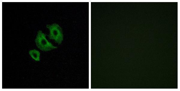 a30857 or10j6p primary antibodies if testing 1