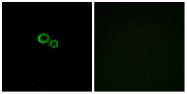 a30858 or11g2 primary antibodies if testing 1