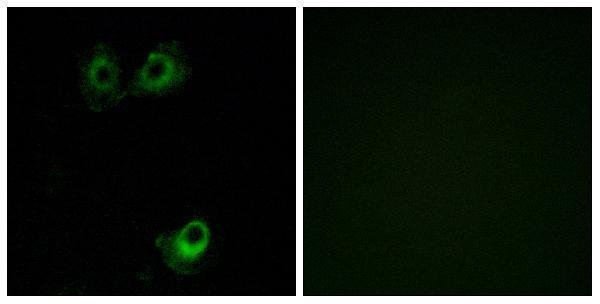 a30859 or11l1 primary antibodies if testing 1