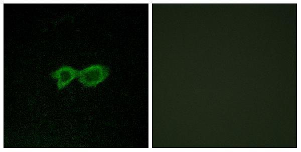 a30861 or13c4 primary antibodies if testing 1