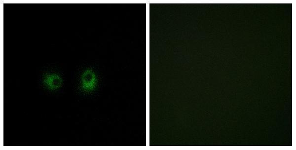 a30867 or2ak2 primary antibodies if testing 1