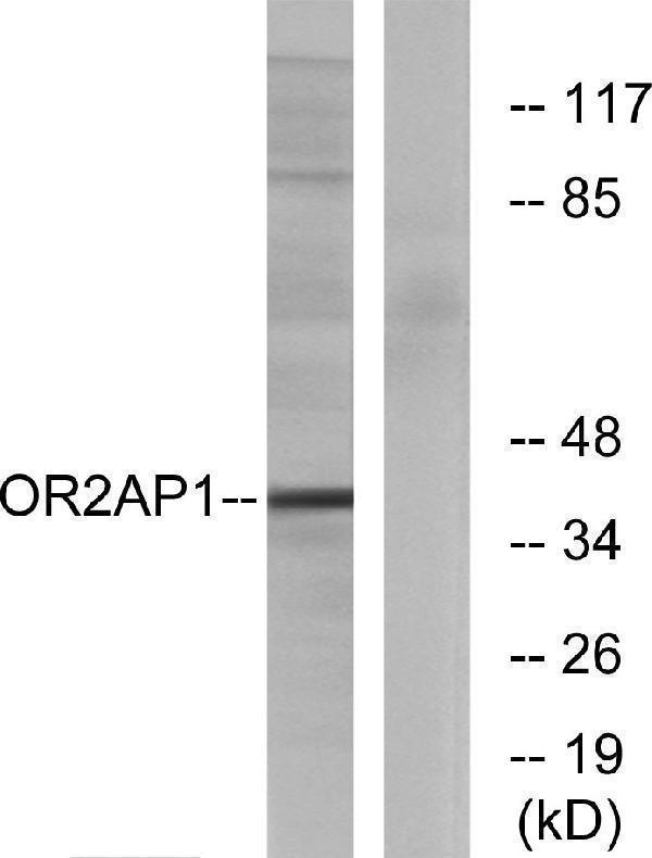 Western blot analysis of lysates from Jurkat cells, using OR2AP1 Antibody