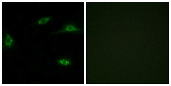 a30870 or2t11 primary antibodies if testing 1