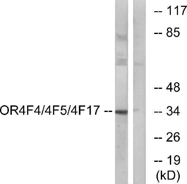 Western blot analysis of lysates from MCF-7 cells, using OR4F4/4F5/4F17 Antibody