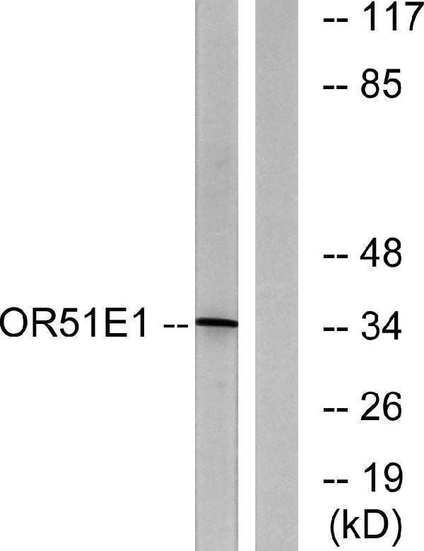 a30874 or51e1 primary antibodies wb testing 3