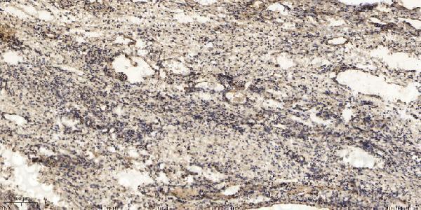 Immunohistochemical analysis of paraffin-embedded human oophoroma