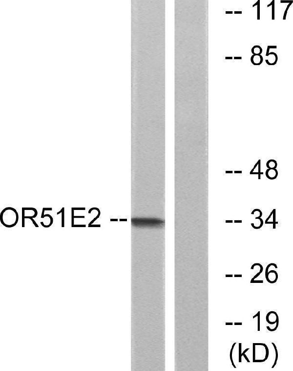 a30875 or51e2 primary antibodies wb testing 3
