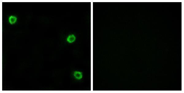 Immunofluorescence analysis of LOVO cells, using OR51Q1 Antibody