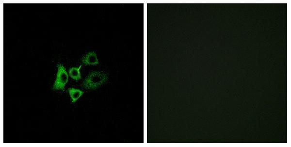 a30881 or51t1 primary antibodies if testing 1