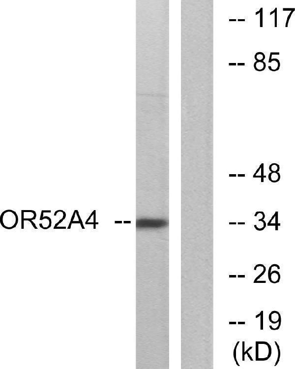 a30882 or52a4p primary antibodies wb testing 1