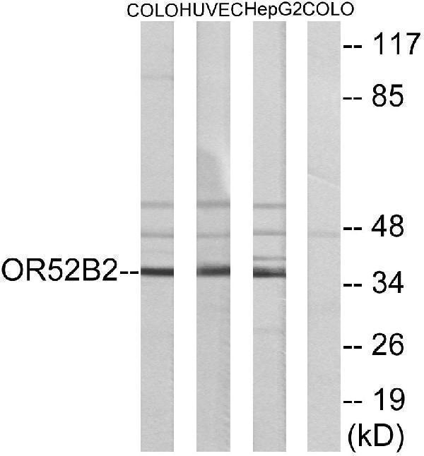 a30883 or52b2 primary antibodies wb testing 3