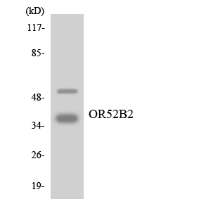 Western blot analysis of the lysates from HepG2 cells using OR52B2 antibody