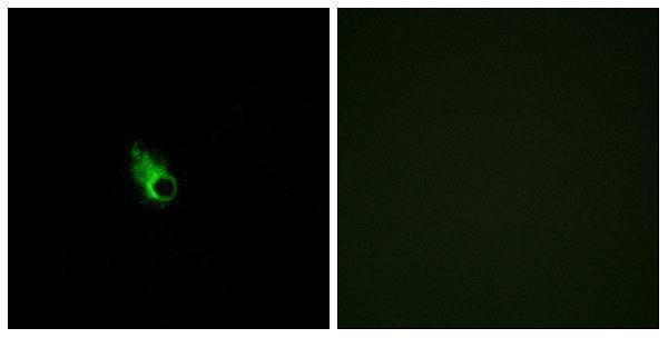 a30885 or52e1 primary antibodies if testing 1