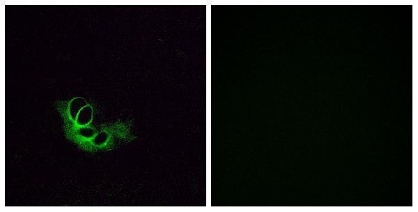 a30890 or56a1 primary antibodies if testing 1