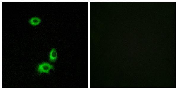 a30891 or56b1 primary antibodies if testing 1