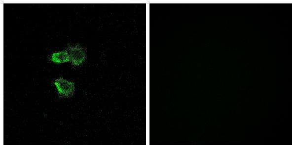 a30892 or56b4 primary antibodies if testing 1