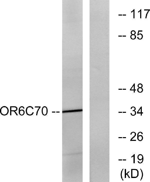 Western blot analysis of lysates from Jurkat cells, using OR6C70 Antibody