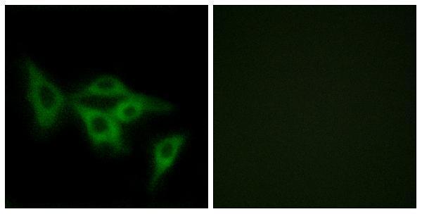a30907 or2i1p primary antibodies if testing 1