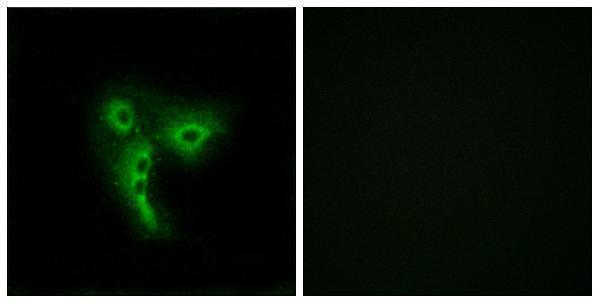 a30908 or4a4p primary antibodies if testing 1