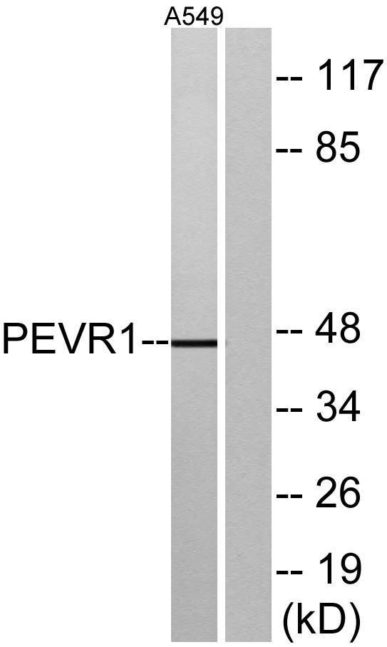a30909 slc52a2 primary antibodies wb testing 3