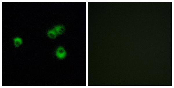a30911 or7e5p primary antibodies if testing 1
